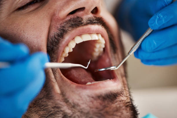 Best Broken or Cracked Tooth Emergency Dentist in Friona, TX